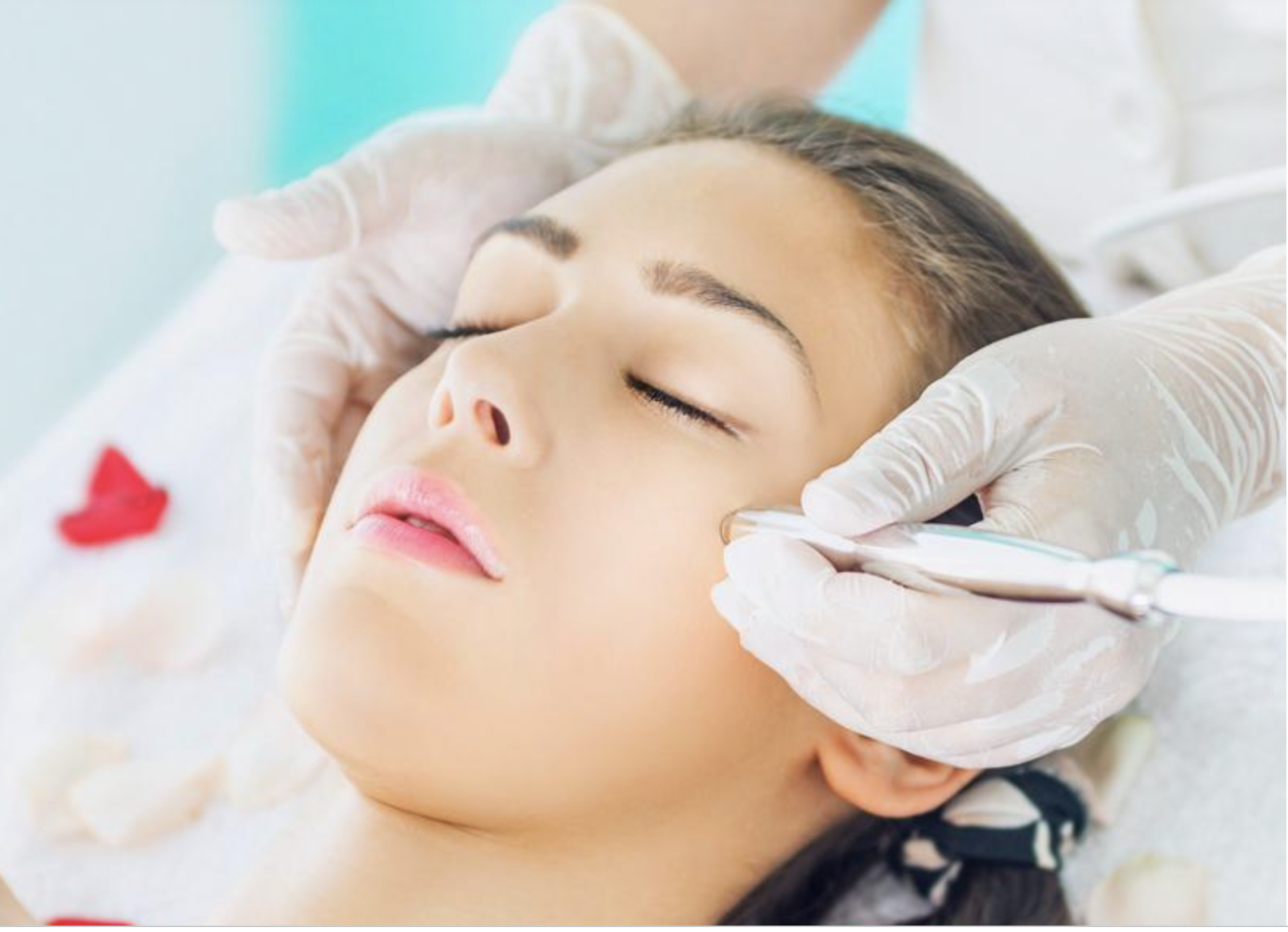Guest Blog: Benefits of Microdermabrasion