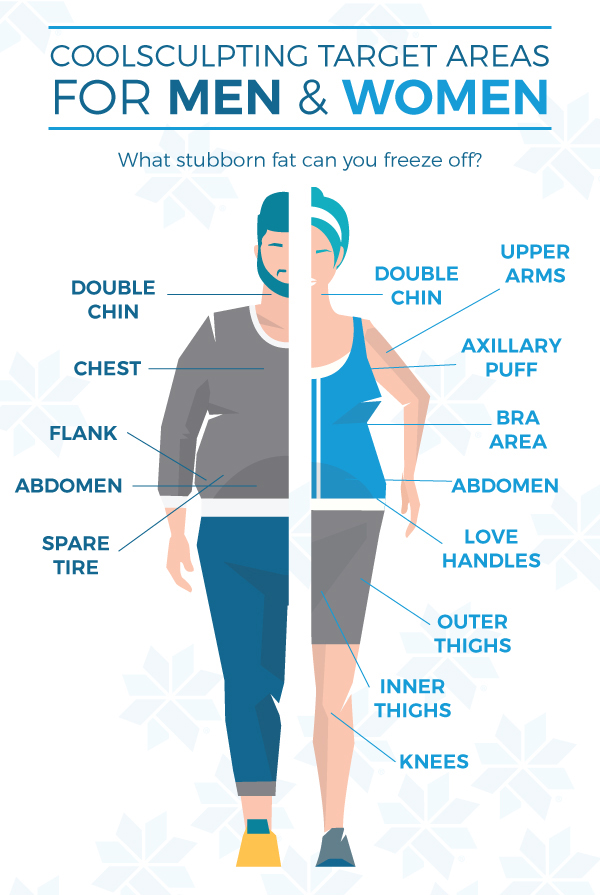 CoolSculpting