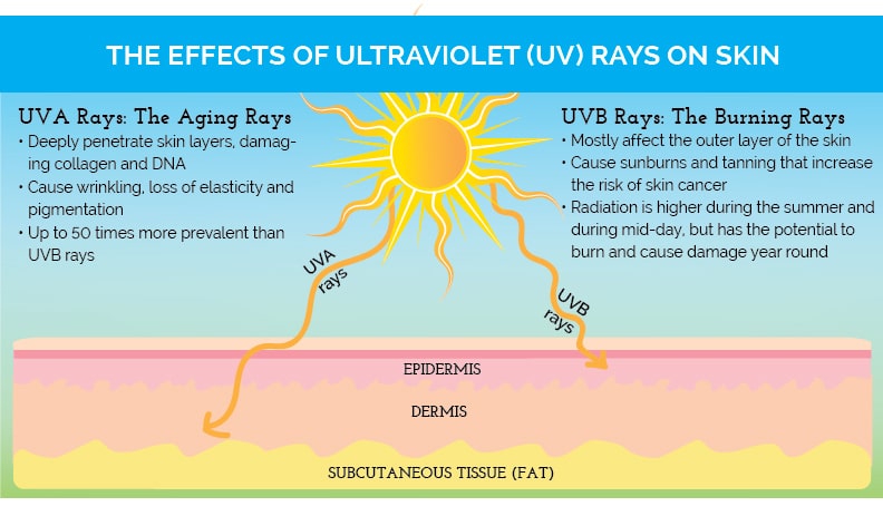Effects of UV rays on skin