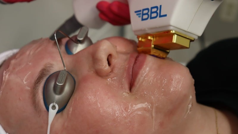 BBL SCITON 800x450