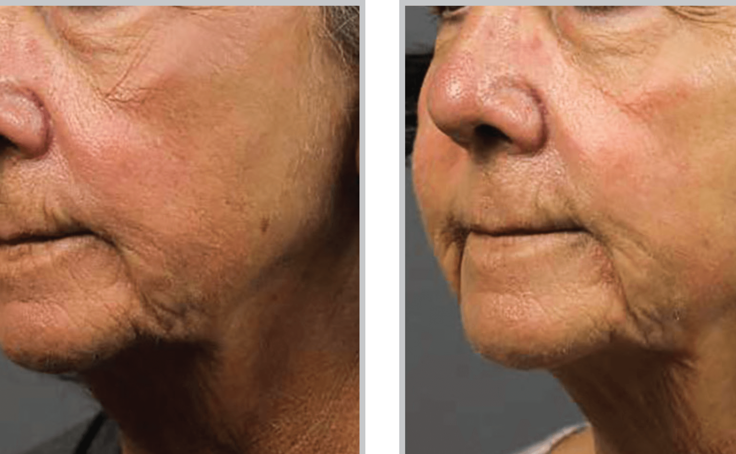 Before and After Image: HALO - left-front-oblique